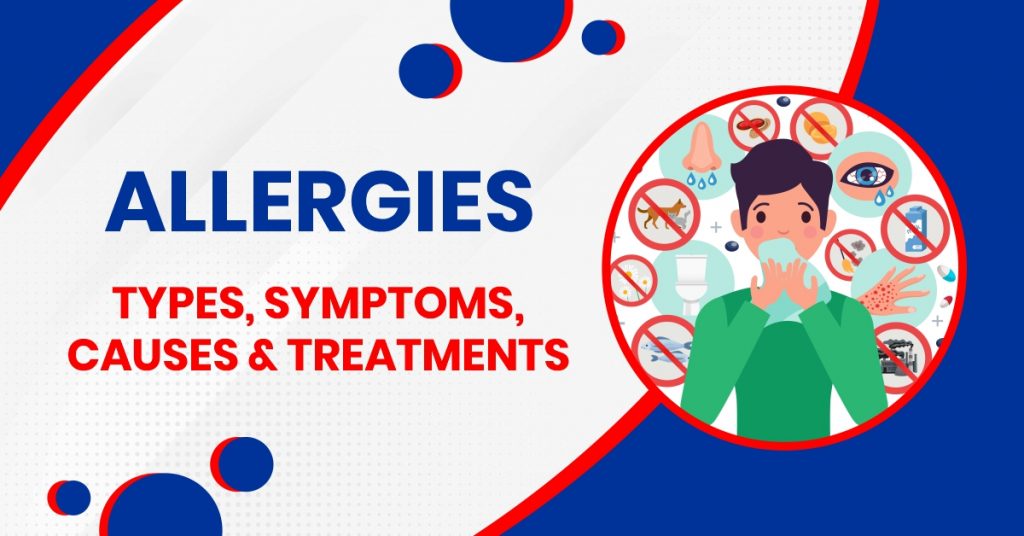 Allergies Types, Symptoms, Causes & Treatments