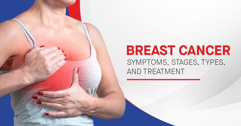 Breast Cancer Symptoms, Stages, Types, and Treatment