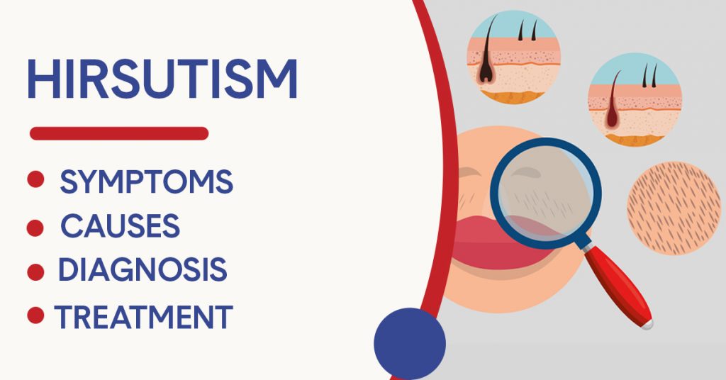 Hirsutism: Symptoms, Causes, Diagnosis, & Treatment - Jaipur Hospital