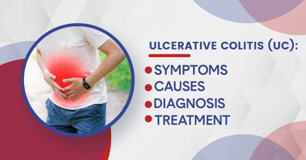 ulcerative colitis symptoms