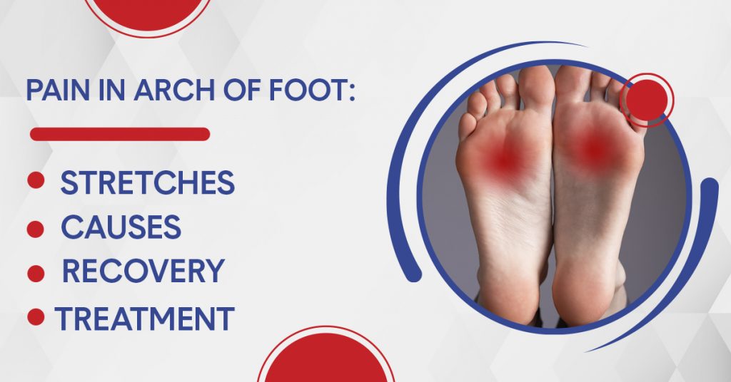 Pain in Arch of Foot Causes, Stretches, Treatment, and Recovery