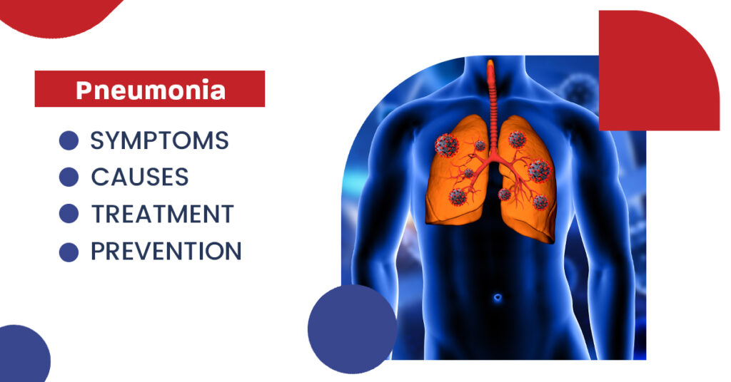 Pneumonia: Symptoms, Causes, Treatment, And Prevention