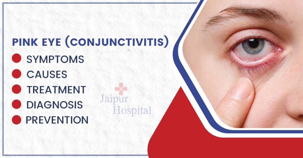 Pink Eye Conjunctivitis Symptoms Diagnosis Causes Treatment And Prevention