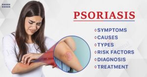 Psoriasis: Symptoms, Causes, Types, Risk Factors, Diagnosis & Treatment