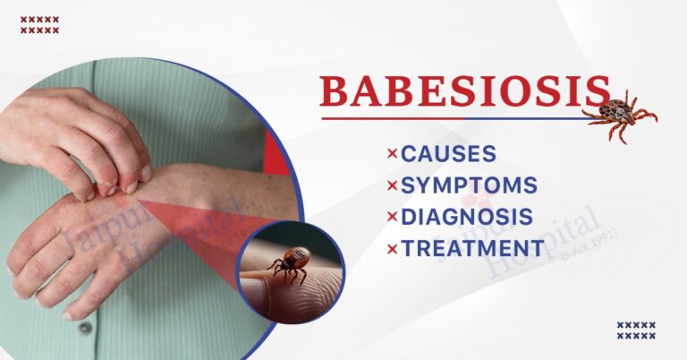 Babesiosis: Causes, Symptoms, Diagnosis & Treatment - Jaipur Hospital