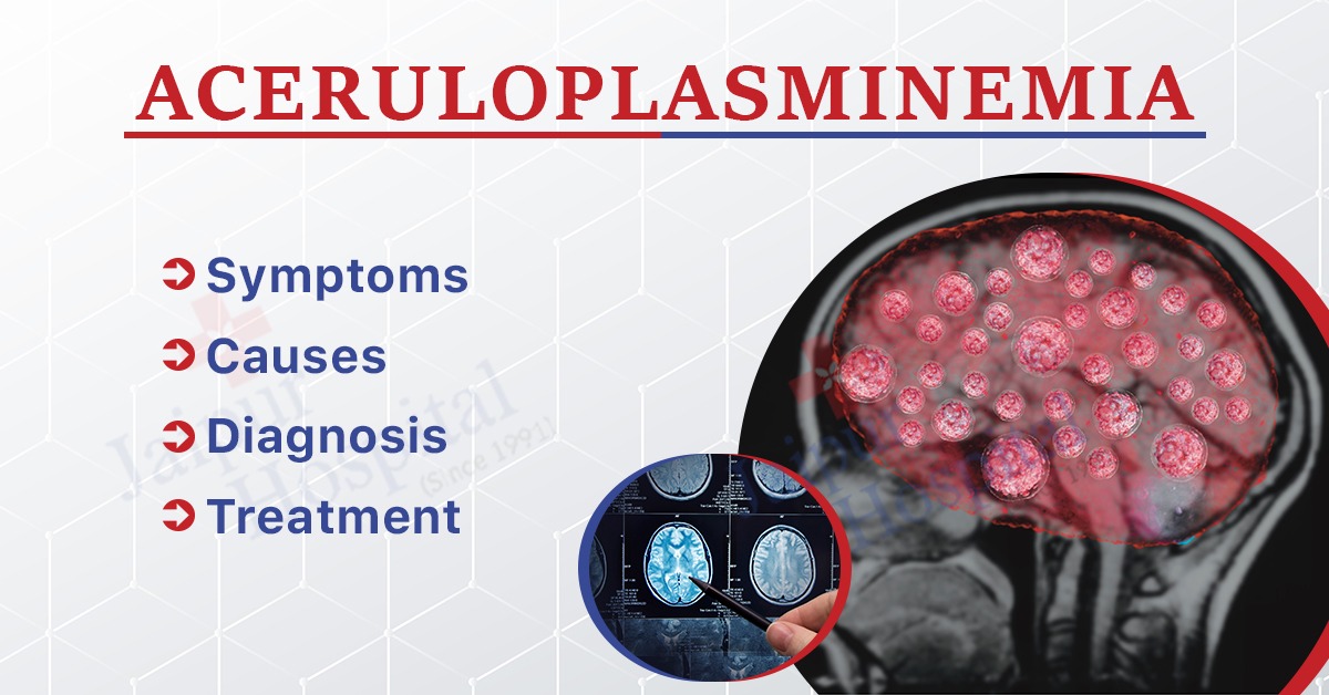 What is Aceruloplasminemia