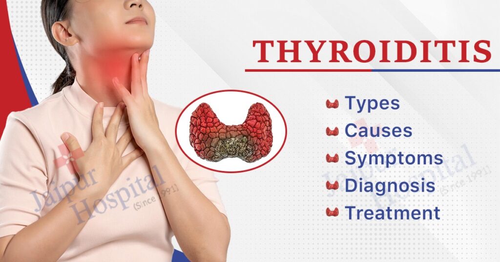 thyroiditis-types-causes-symptoms-diagnosis-treatment