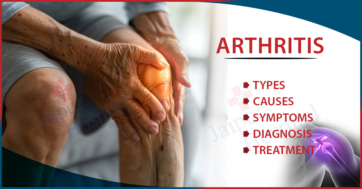 Arthritis