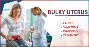 Bulky Uterus: Symptoms, Causes, Diagnosis & Treatment