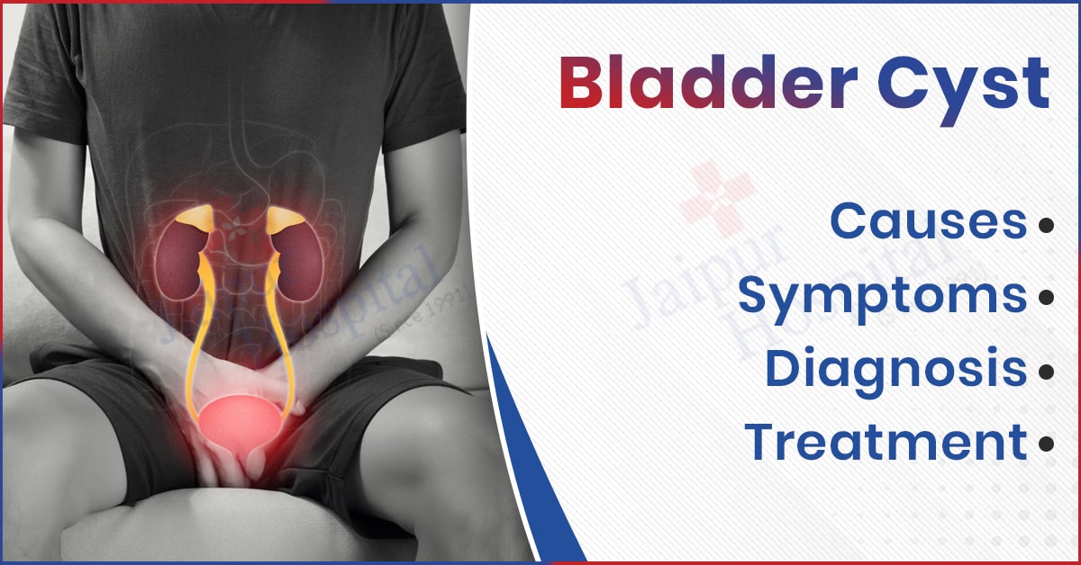 Bladder Cyst