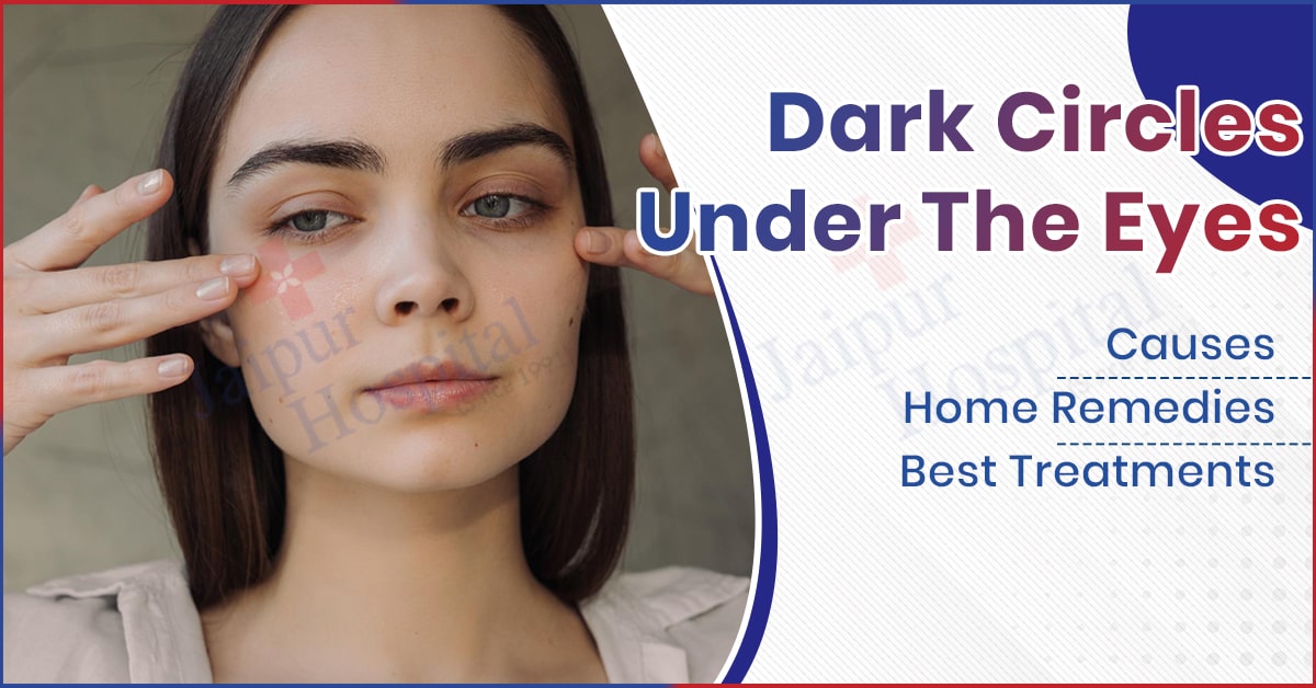 Dark Circles Under The Eyes