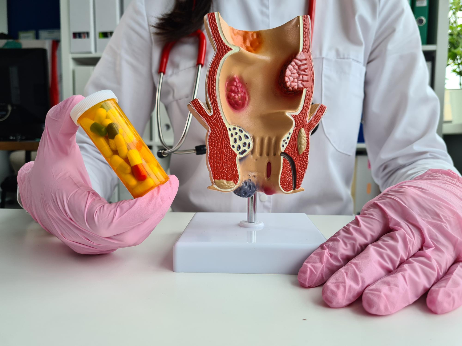 Piles, Fissure & Fistula Treatment