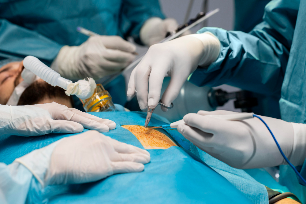 Minimally Invasive & Laparoscopic Urological Surgery