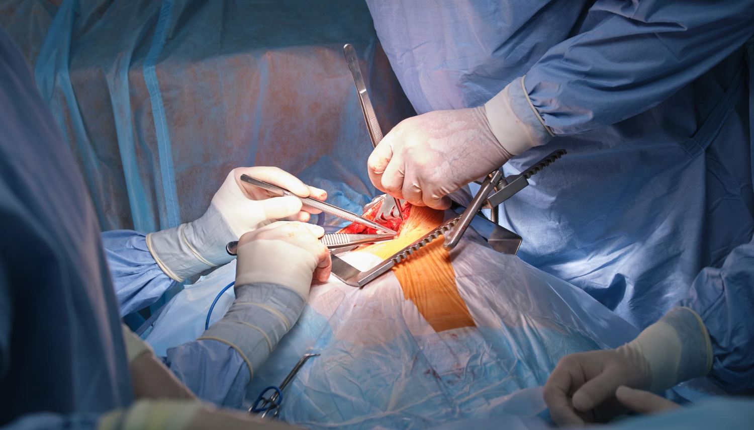 Laparoscopic Gallbladder & Appendix Surgery