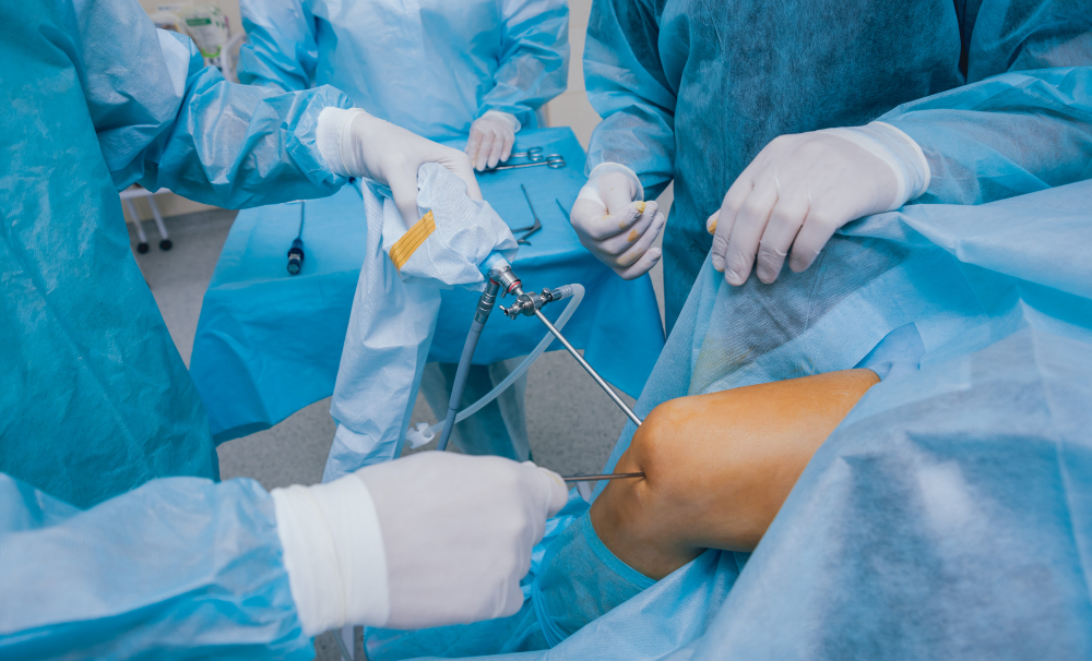 Arthroscopy (Keyhole) Surgery