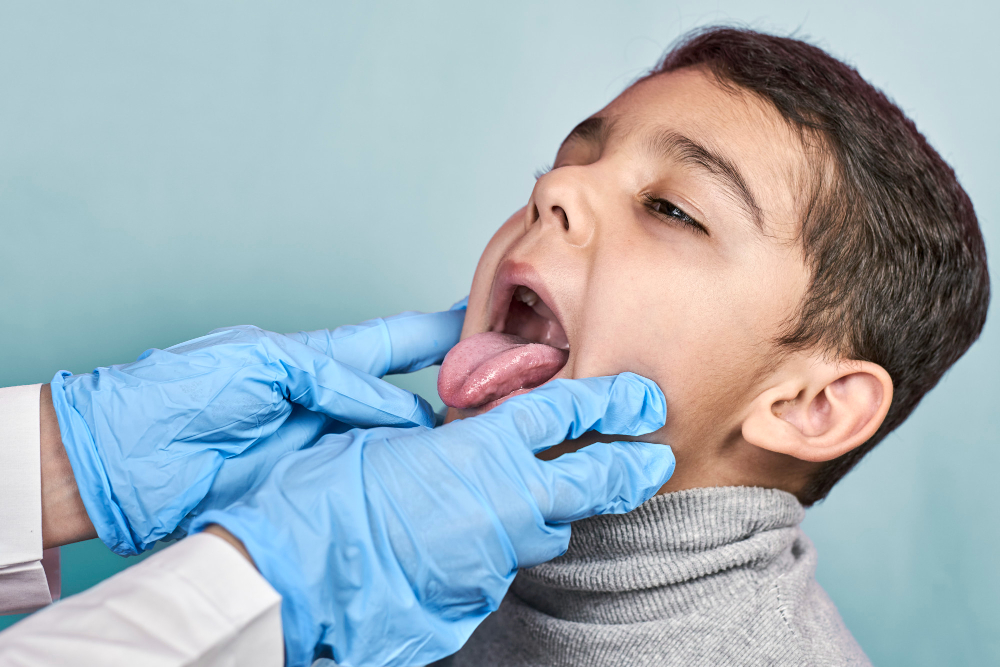 Tonsillitis Treatment