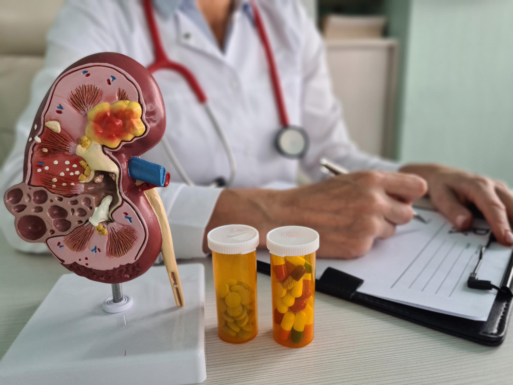 UTI Treatment